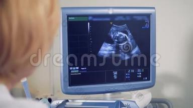 有胎儿图像的超<strong>声波</strong>监视器。 医学超<strong>声波</strong>扫描。